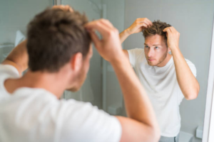 How to Get Rid of Dandruff: A Guide for Men and Women in 2024