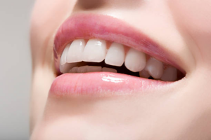 Teeth Whitening: A Comprehensive Guide to The Perfect Smile